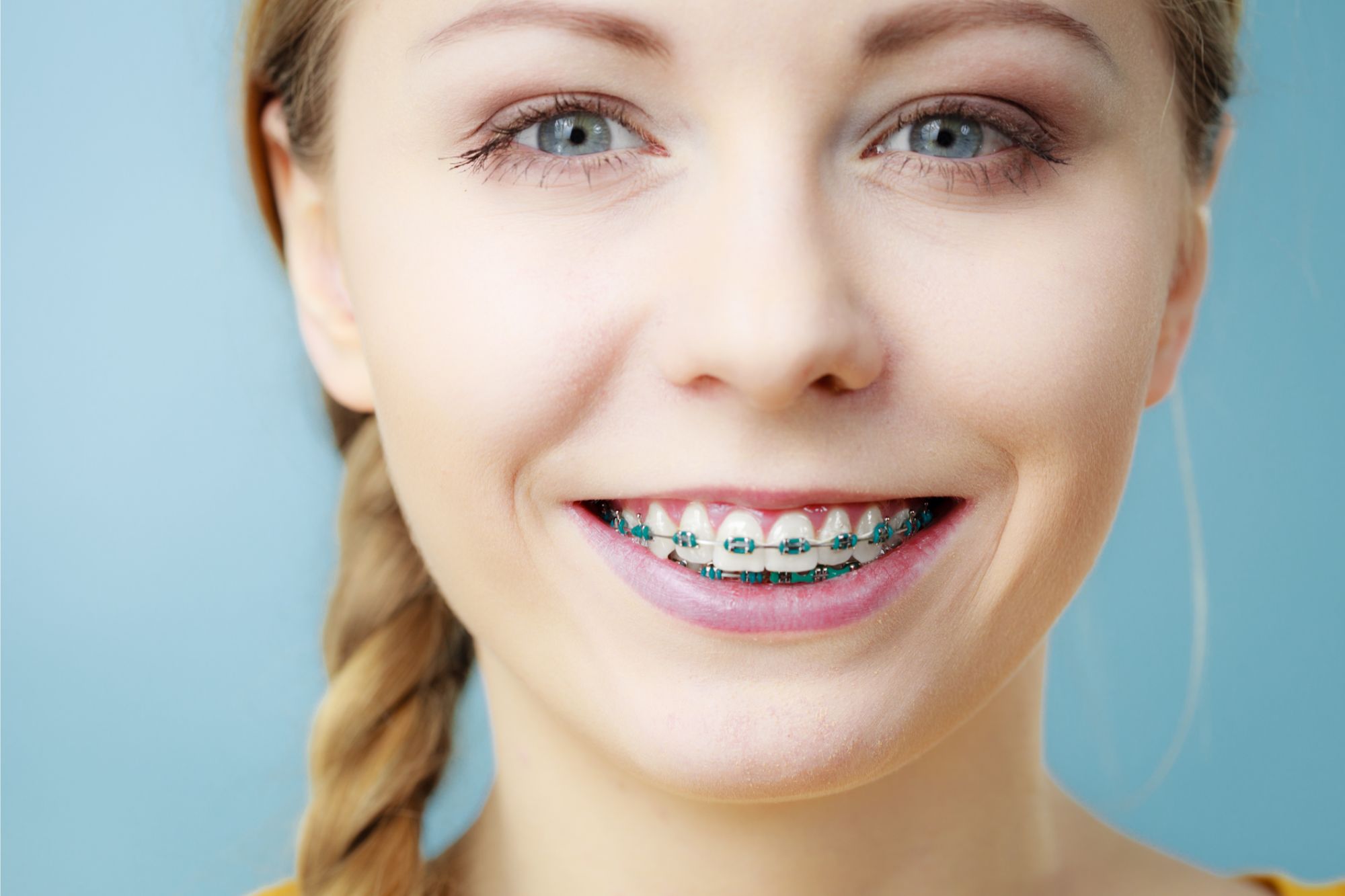 New Haven Braces